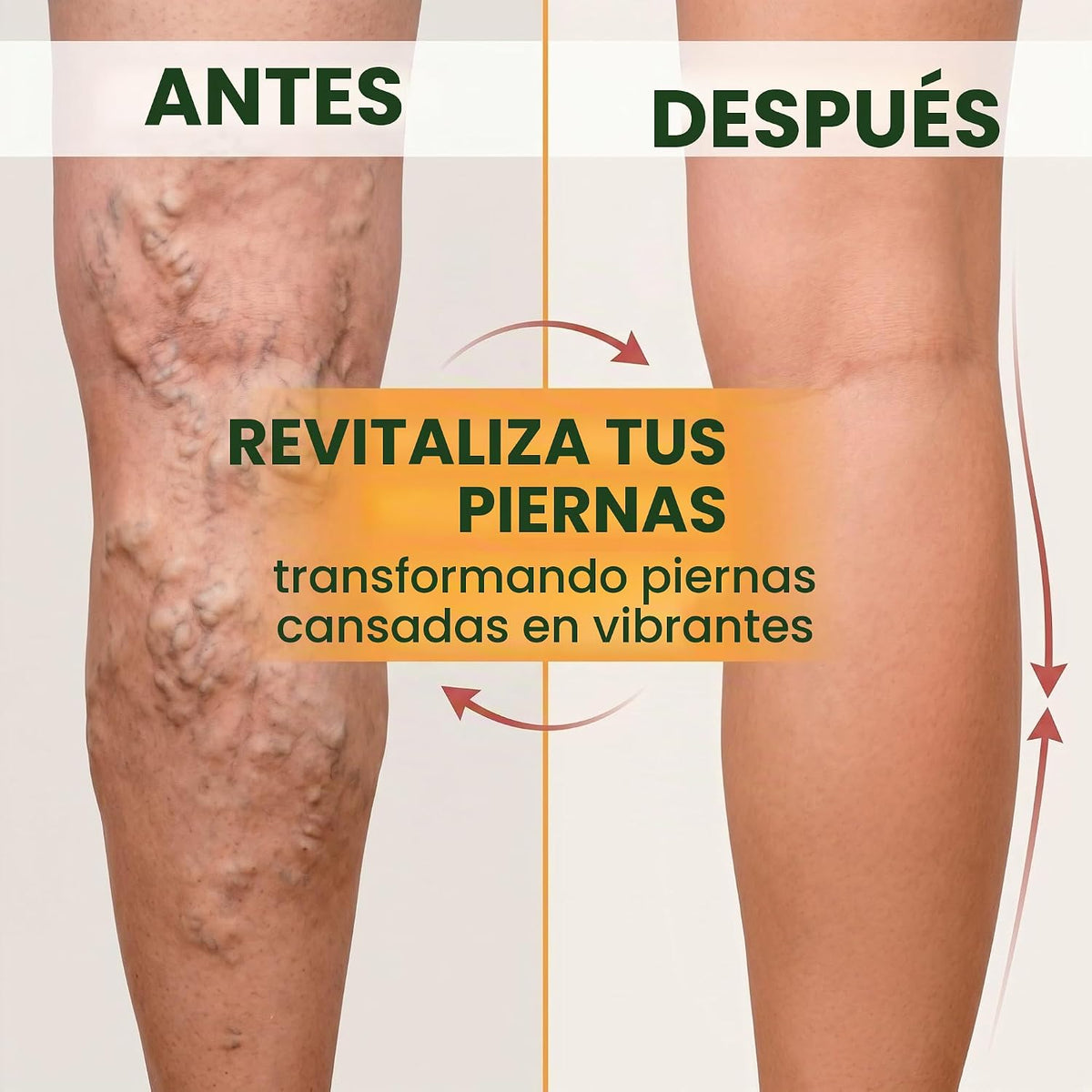 Parches Naturales Anti Varices - Varicose Veins®