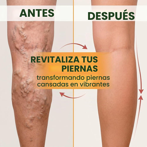Parches Naturales Anti Varices - Varicose Veins®